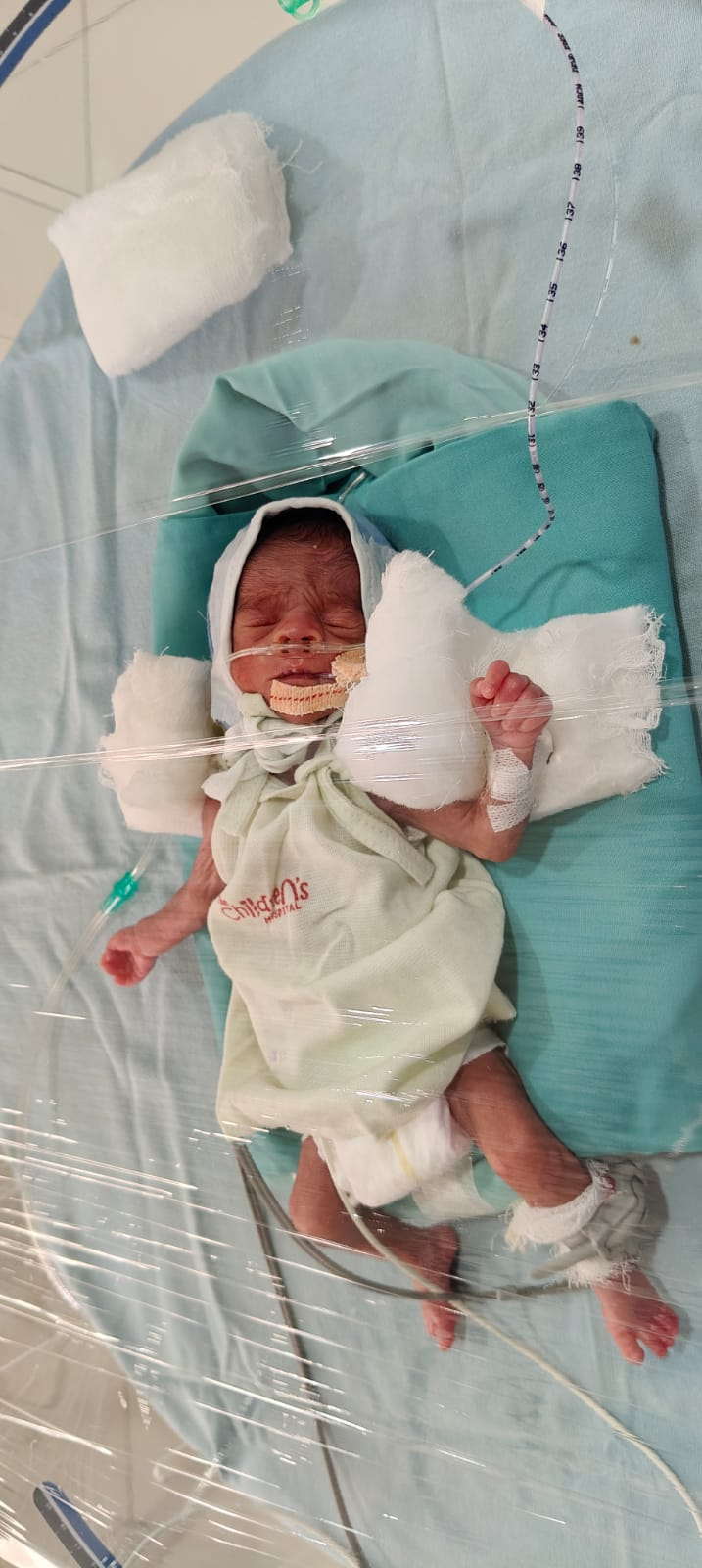 Newborn hospital care