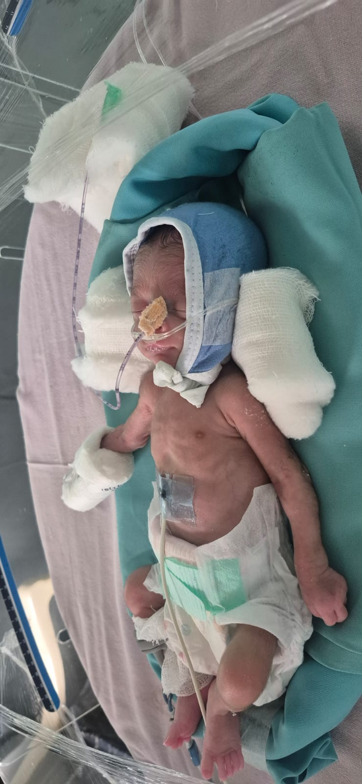Baby foot